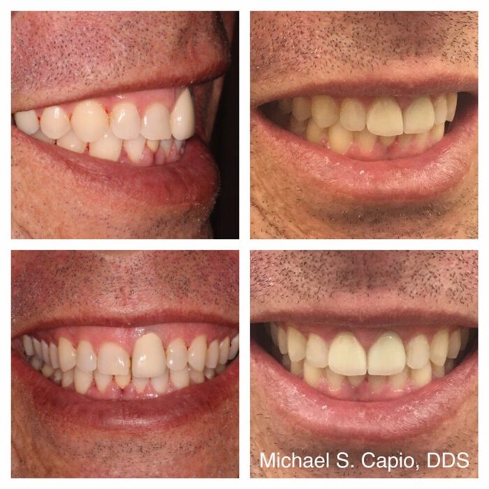 Orthodontics - Cosmetic Dentistry - Dr Capio 90045