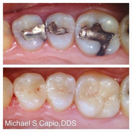 LAX Westchester Excellent Dentist - Dr Michael Capio